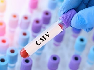 Cmv